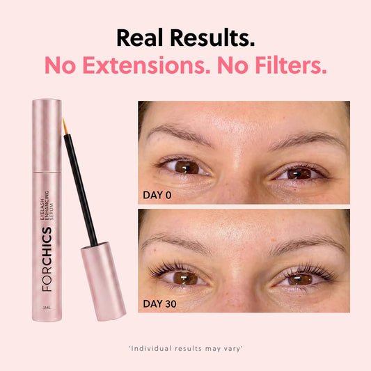 ForChics Eyelash Growth Serum Prostaglandin-Free for Longer Thicker Lashes & Brows Vegan 3ml